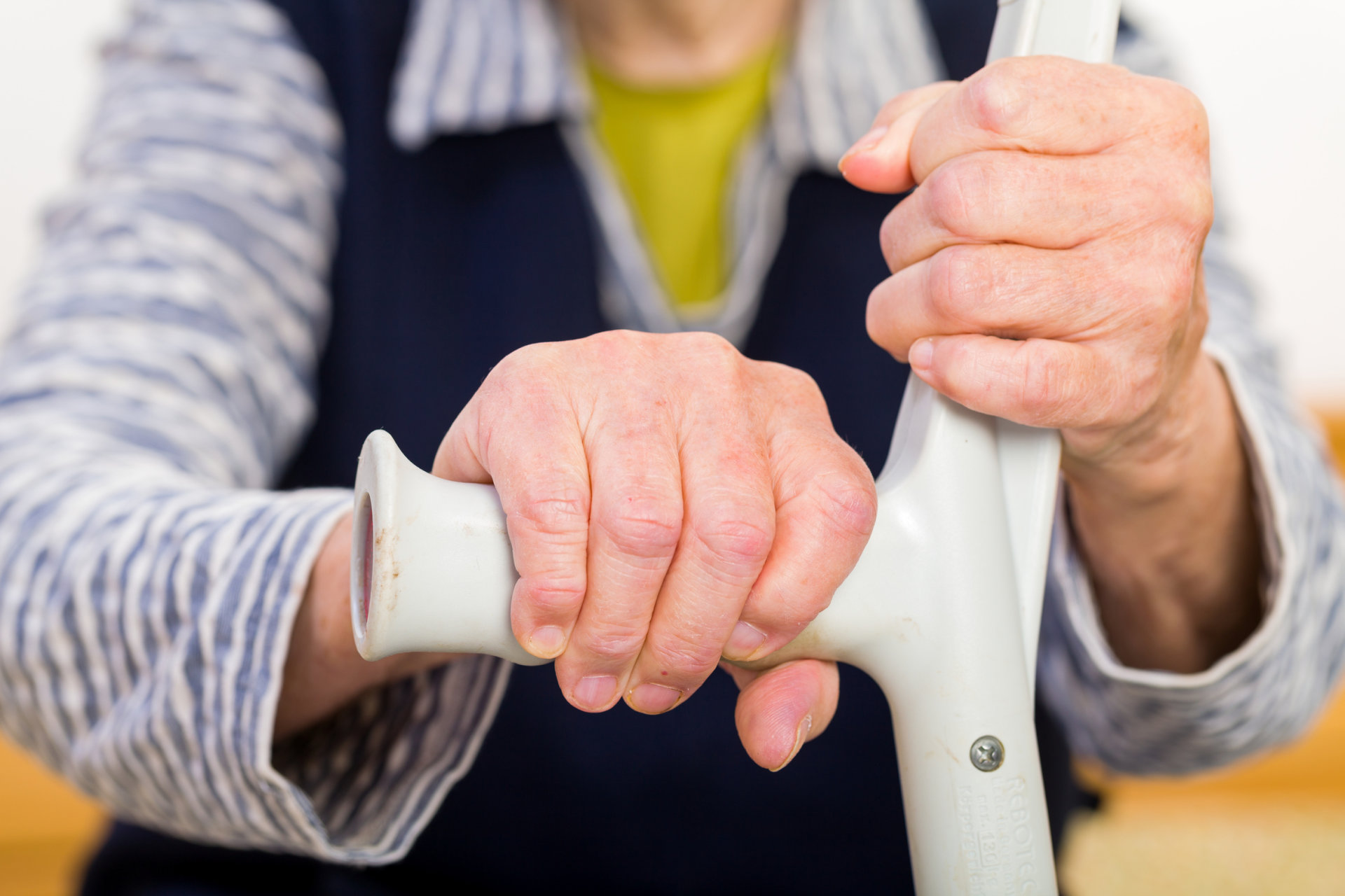 artritas rankų ir jo pasekmes osteomielitas sustav gydymas