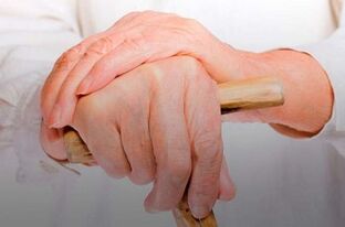 kremai sergančių sąnarių gydymas artrozė mases