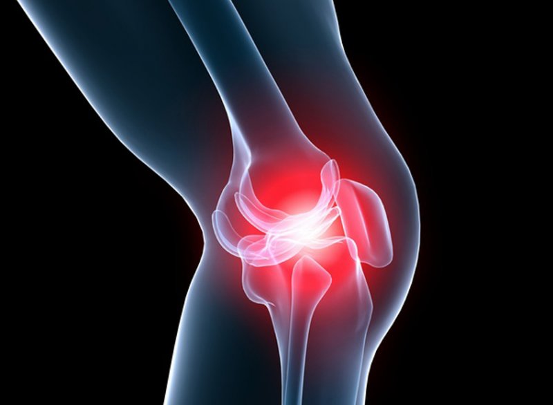 ligos nuo žmogaus pėdos sąnarių reumatoidinis artritas amzius