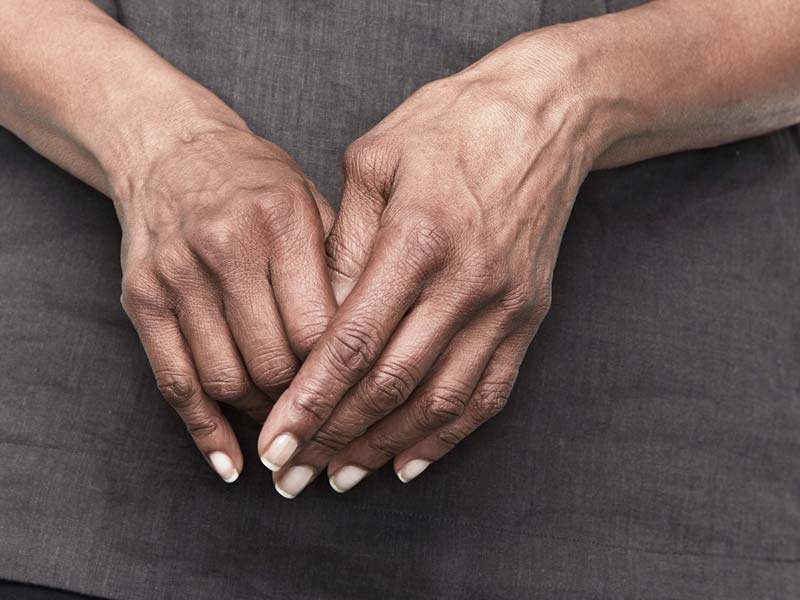 artritas rankos pirštų