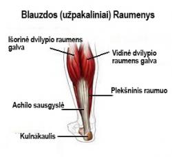 artrozės 3 laipsnių pėdos gydymas