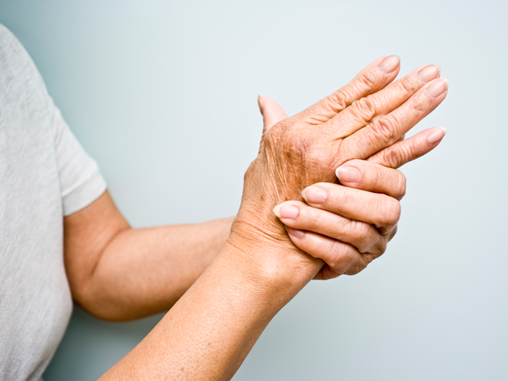 reumatoidinis artritas apatinio žandikaulio sąnarių