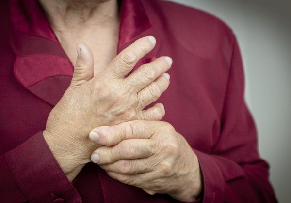 kur nepilnamečių reumatoidinis artritas yra traktuojami