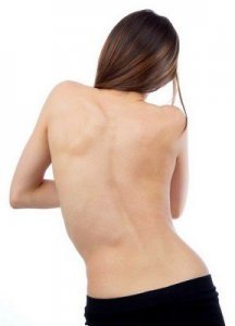 bodyrec priemonė nugaros skausmas ir sąnarių