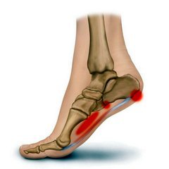 skausmas mažų sąnarių pėdos priemonės skirtos sąnarių uždegimu gydymas