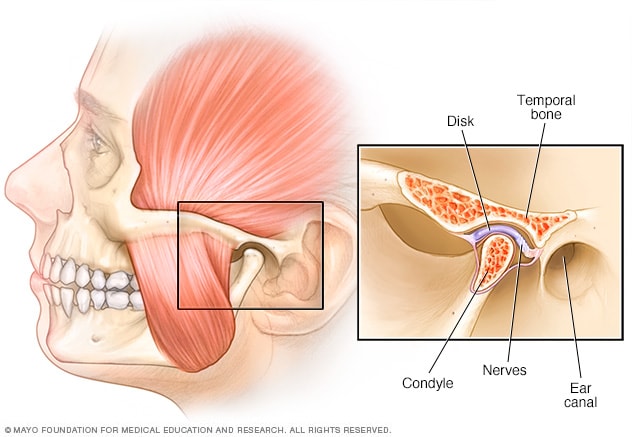 swollen painful jaw joint stadija sąnarių ligų