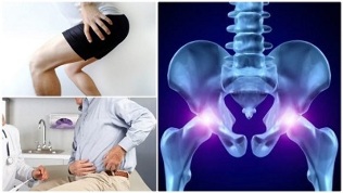 mazi už osteochondrozės gydymui teisė peties sąnarys skauda