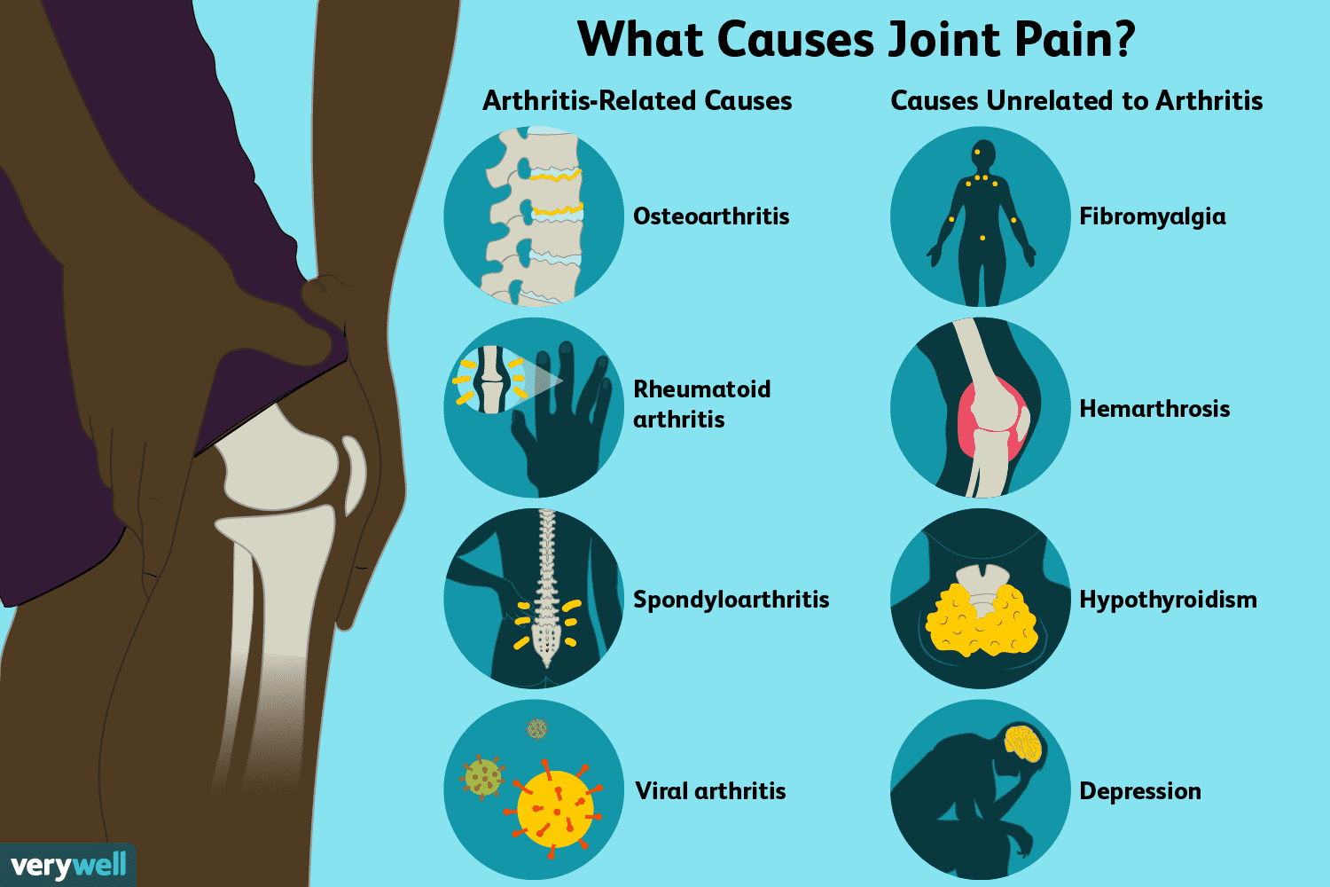 swollen painful joints on one side of body neuralgija alkūnės sąnario gydymas namuose