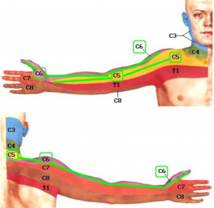 osteochondrozė skausmas peties sąnario dešinės rankos garsiakalbiai jungtinio iš elbowee