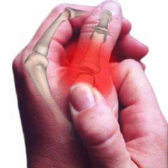 gydymas artrozė pirštų šepečiu skauda iš kairės rankos kai lankstymo sąnario