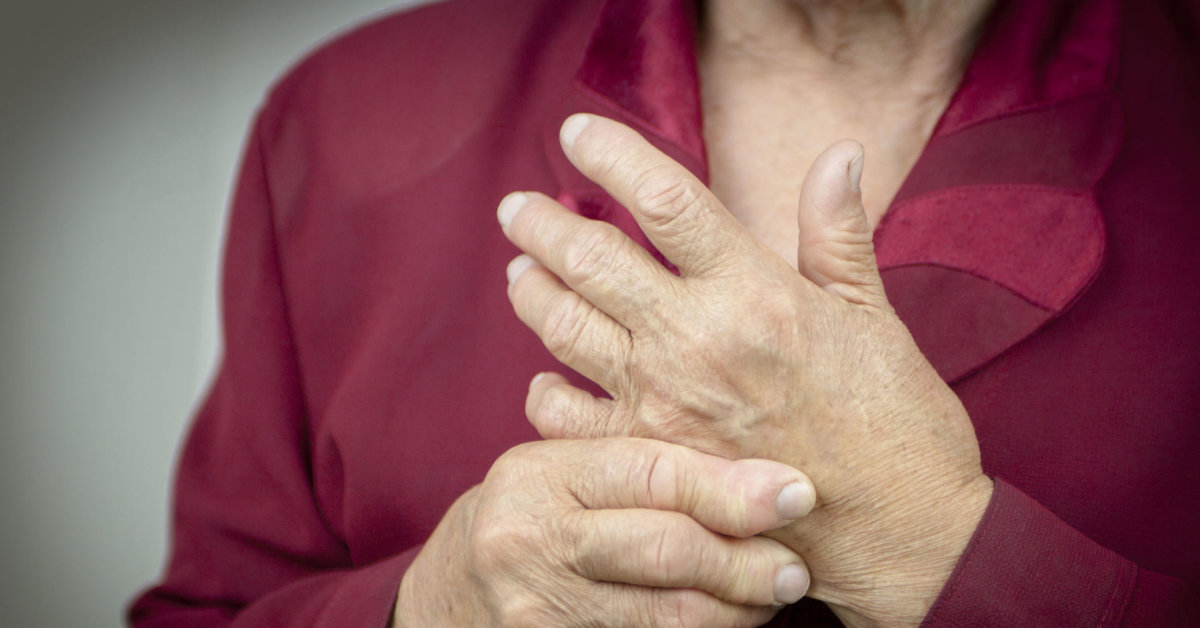 reumatoidinio artrito pirštai koks gydymas osteoartrito