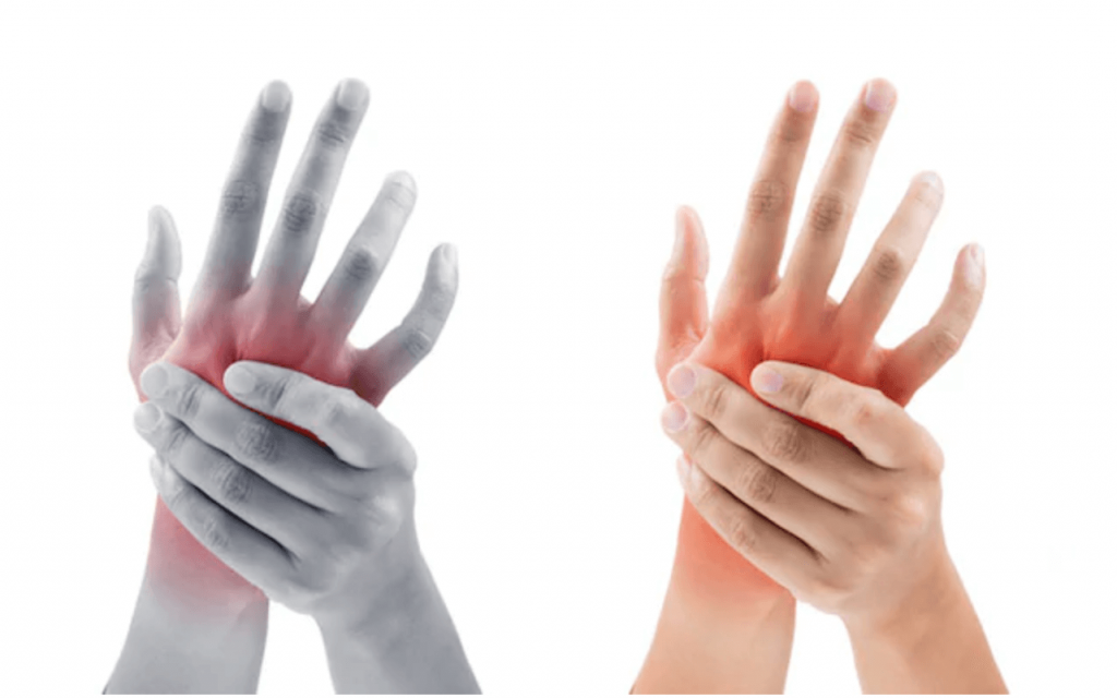 laikykite rankas sąnarius kai lankstant priežastį osteochondrozė kaklo gydymas liaudies gynimo