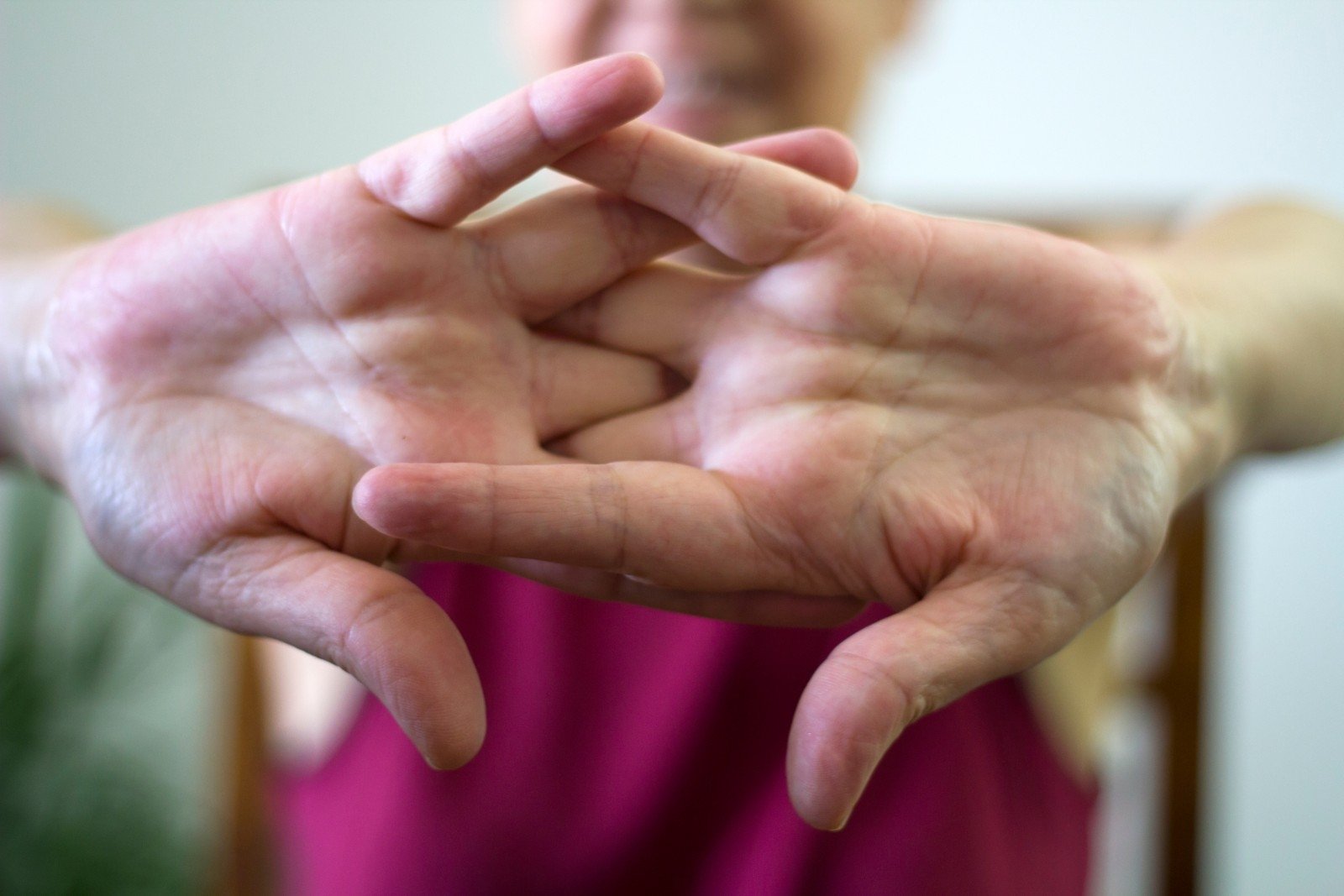 ligų moterų sąnarių gali būti taikoma ar osteoartrito gydymui