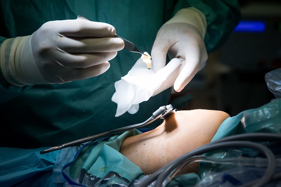 chirurgija sąnarių ligos jei krūva alkūnės sąnario