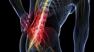 gydymas artrozė nuosėdos liaudies metodų gelis sąnarių reumatas