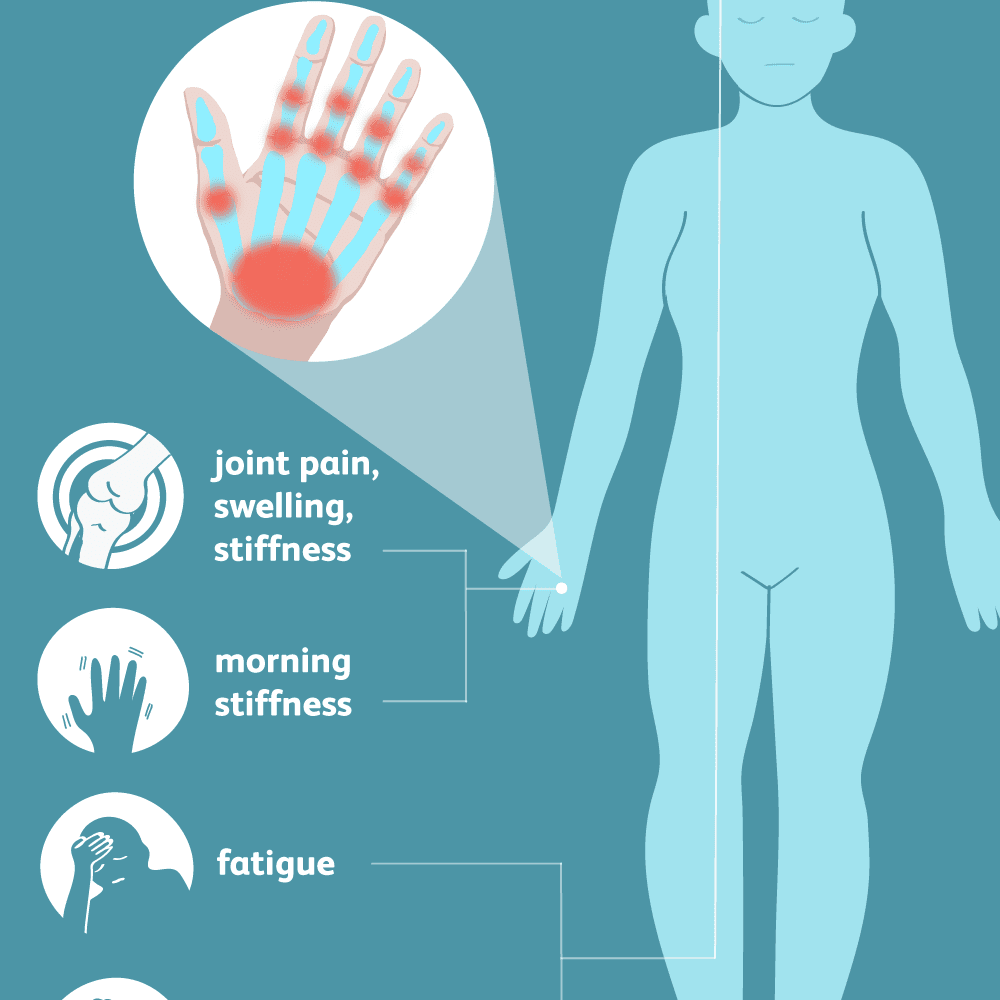 swelling in joints on one side of body gydymas artrozės nuo pirštų rankų sąnarių liaudies gynimo priemones