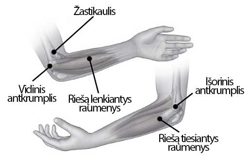 alkūnės jungtinio 1 laipsnio gydymo artrozė skausmas sąnarių rankų šepečiai