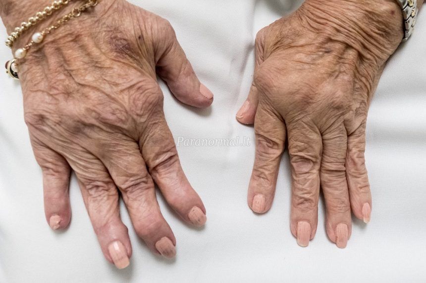 artritas piršto klajojo skausmą sąnariuose bei raumenyse