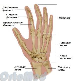 artrito pirštų rankų šepečiai kaip gydyti infekcines artrozės