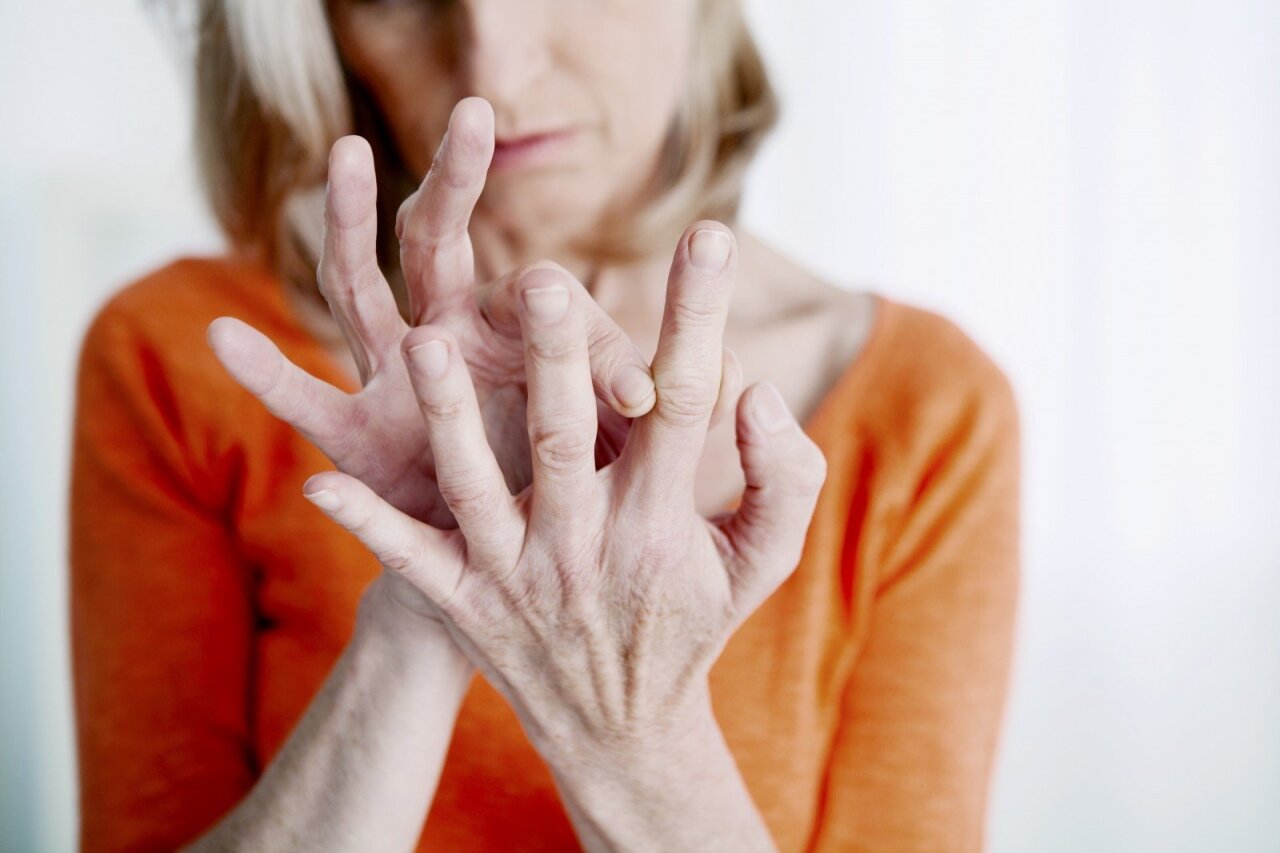 artrito požymių ant riešo tepalai osteochondrozė visi