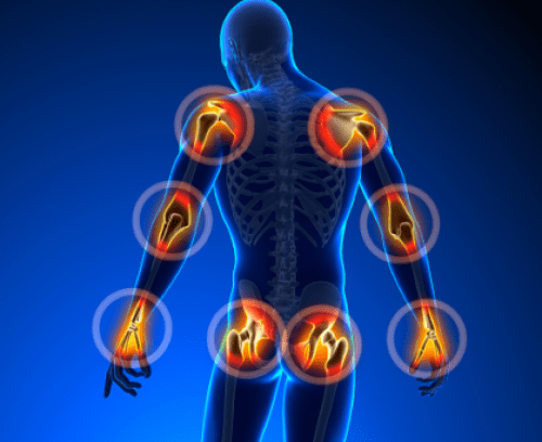 vaistas skausmą osteoartrito