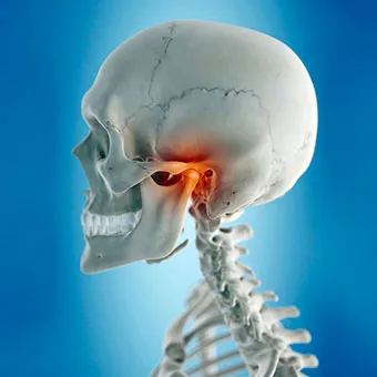 swollen painful jaw joint artritas kairiojo peties sąnario kas tai yra