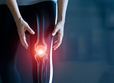 gydymas osteoartrito ir bursito ligos kurių sąnariams