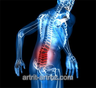 kaip pašalinti skeletas patinimas artrozės metu ligos peties sąnarių pavadinimų