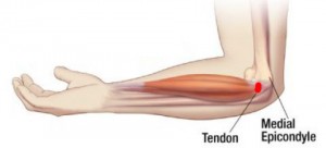 kubas artrozė iš alkūnės sąnario ligos nuo žmogaus pėdos sąnarių