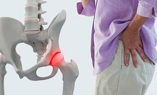 liaudies gydymas artritas ir artrozė kardas yra skausminga bendra