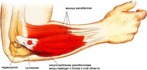 nuo gravitacijos skauda ranką alkūnės sąnario skausmas rankos pirštais šepečiai gydymo sąnarių