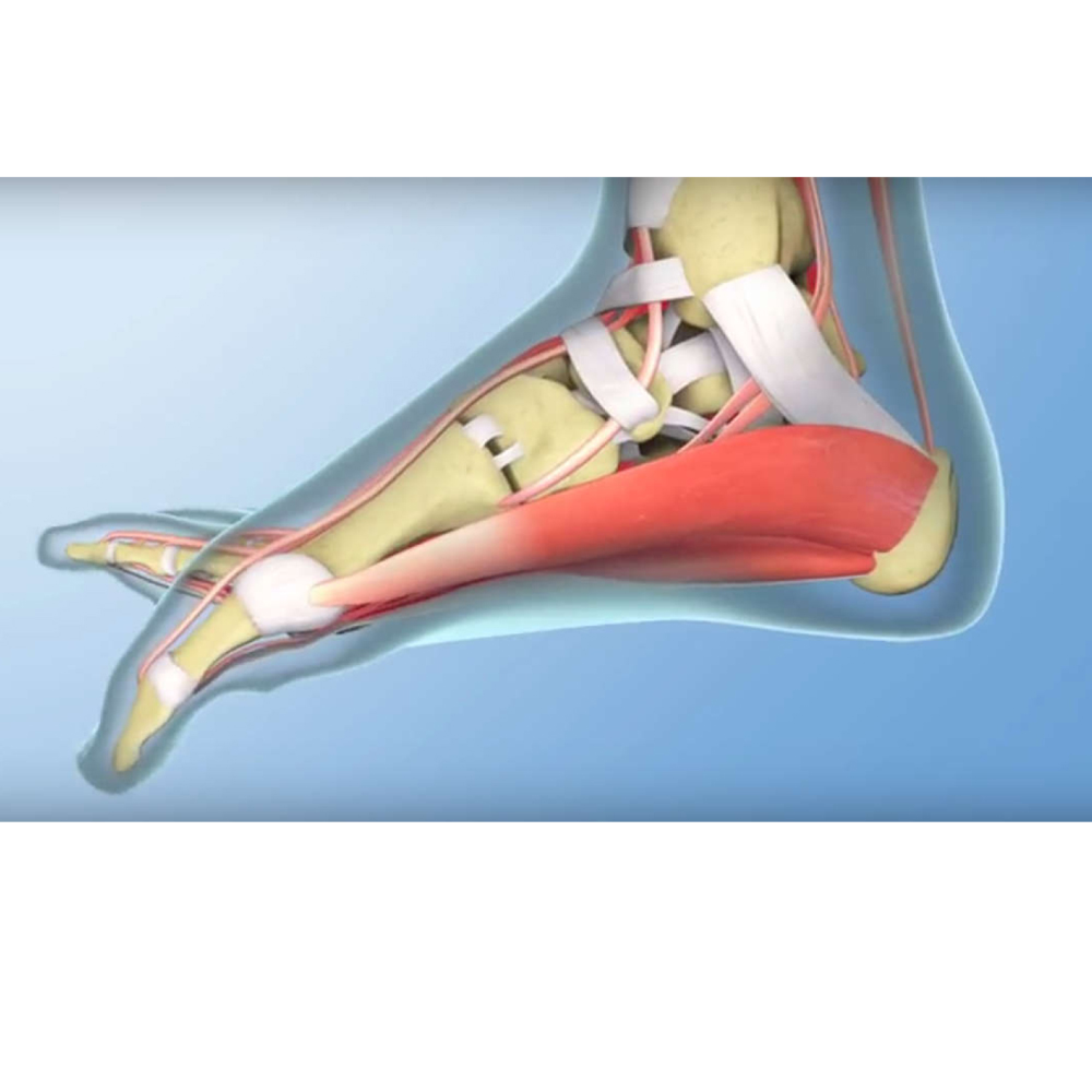 pėdos skausmas priežastys ligos iš artrozės sąnarių
