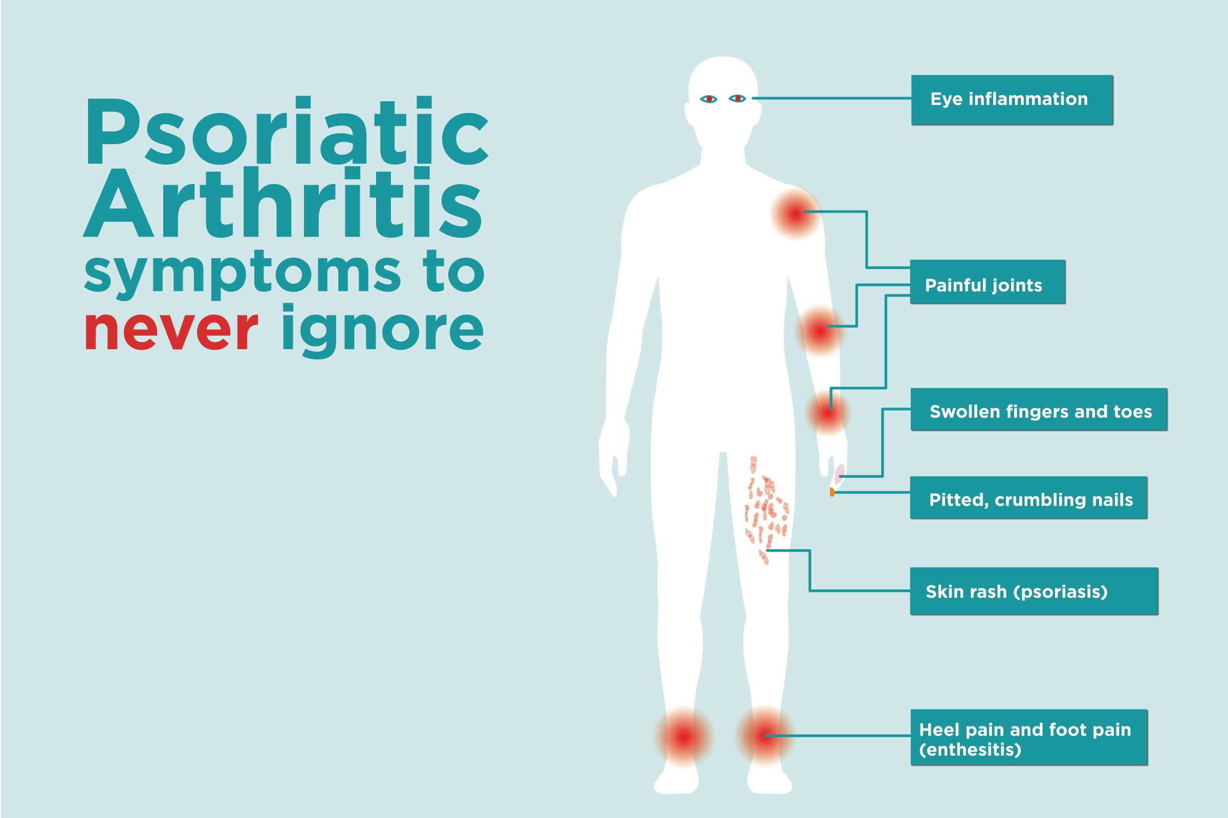 psoriasis artritas simptomai jei yra sąnarių skausmas