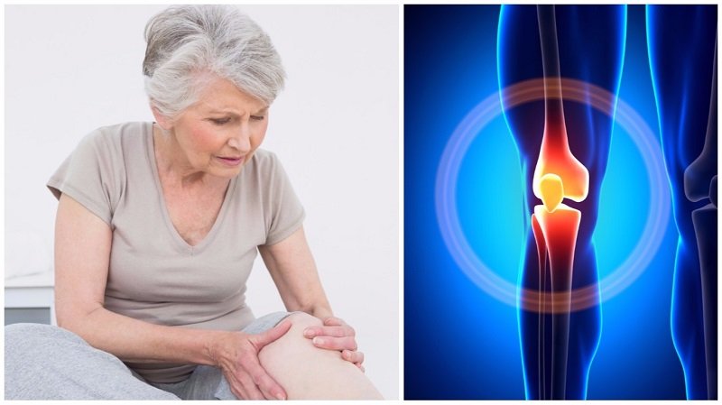 skausmas alkūnės sąnario yra pirštų stuburo isvarza kojos skausmas