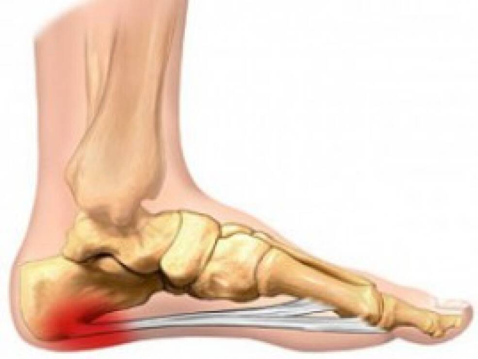 artritas iš dešinės kojos sąnarių
