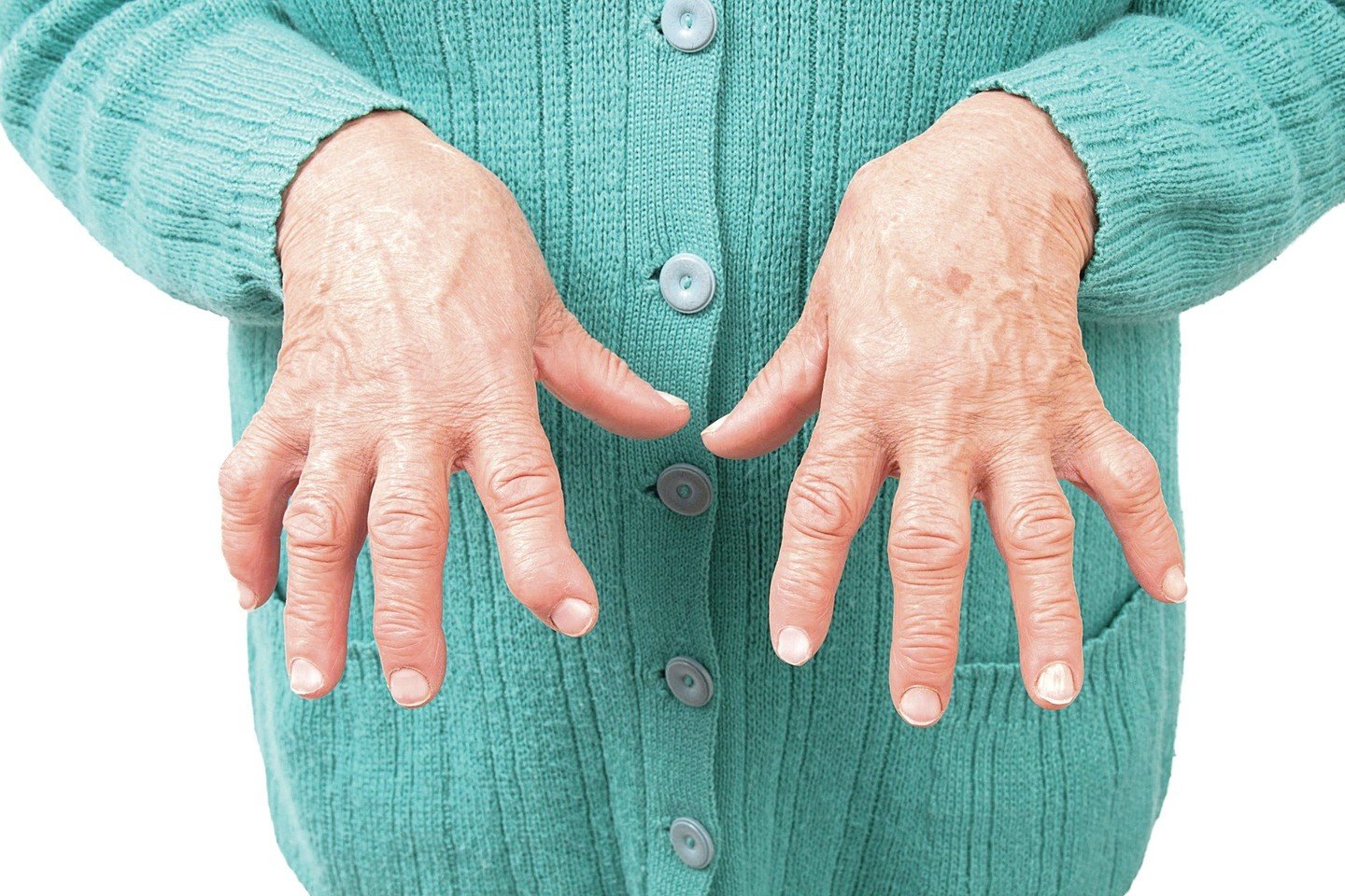 rankos sausgysliu skausmas kur pradėti artrozė 2 laipsnių gydymo