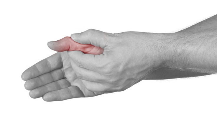 artrozė artritas mažųjų sąnarių šepečiai