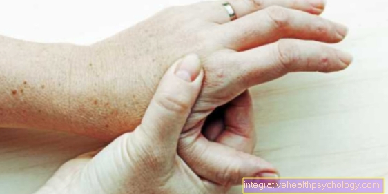 artrozė pirštai rankos gydymas