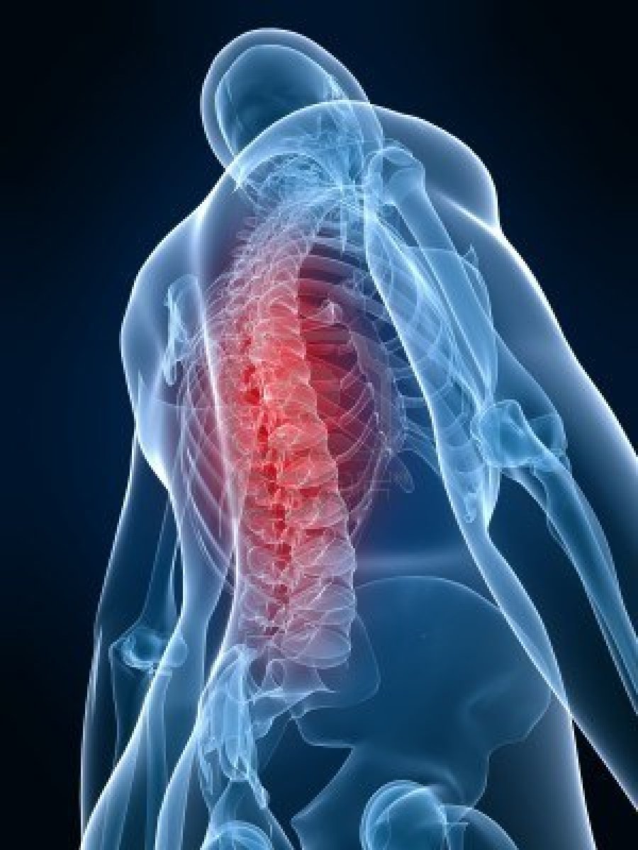 stiprus skausmas sąnarių ir nugaros gydymas sąnarių laminaria
