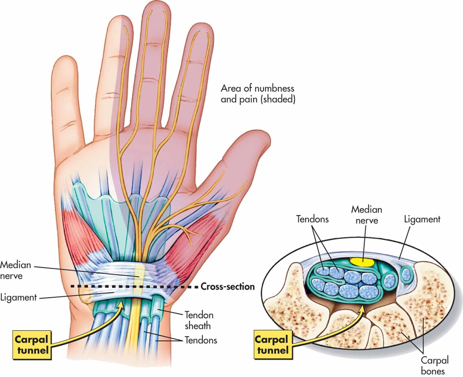 skausmas dešinėje alkūnės sąnario kiek laiko sąnarių gerklės artrito metu