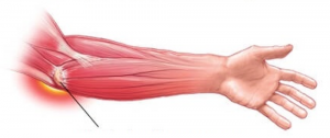 raumenų ir sąnarių tepalas kaina venusal ligos gerklės jungtys